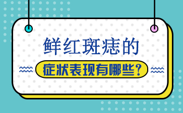 南京去除胎记哪个医院最好？鲜红斑痣的症状表现有哪些？