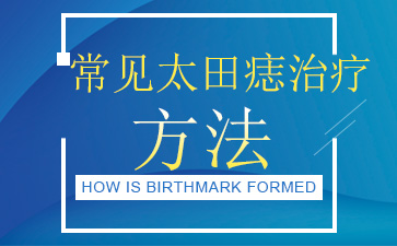 南京祛除胎记的医院讲述太田痣怎么治疗